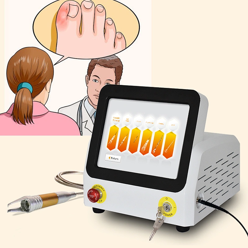 laser toenail nail fungus treatment machine