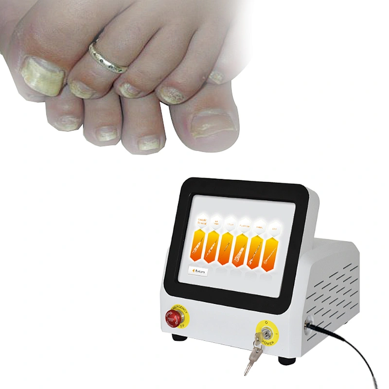 New sale 60w podiatry laser 980nm diode laser nail fungus treatment equipmen