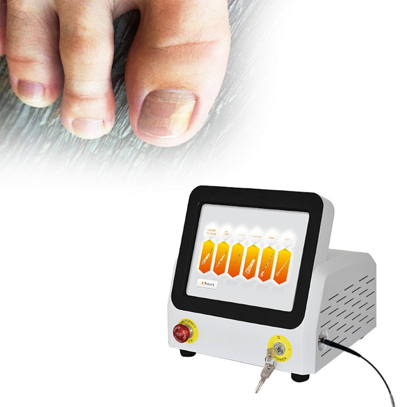 New sale 60w podiatry laser 980nm diode laser nail fungus treatment equipmen